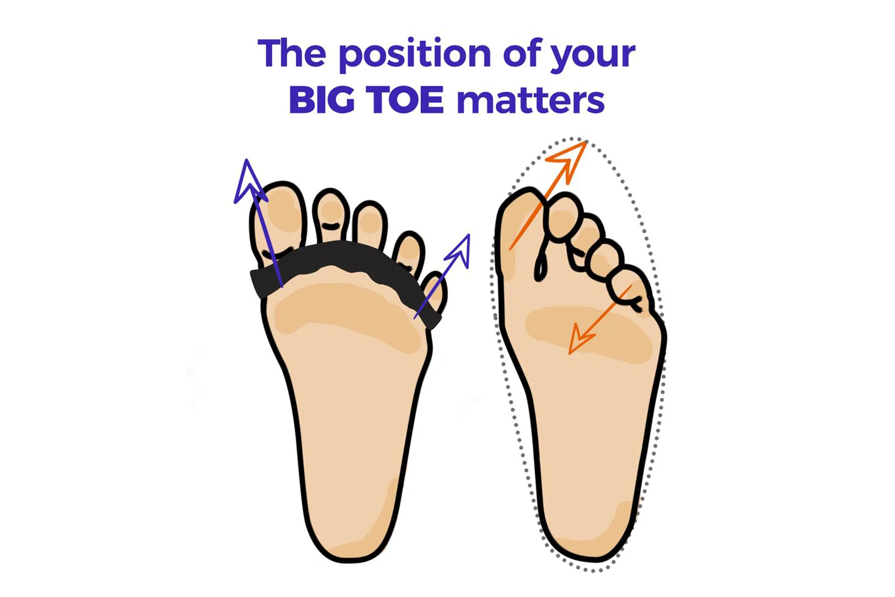 The Toe Spacer - Image 4